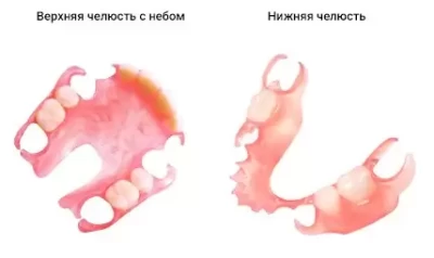 Частичный протез Acry-Free