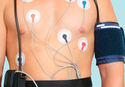 Суточное мониторирование сердечного ритма (ХОЛТЕР)