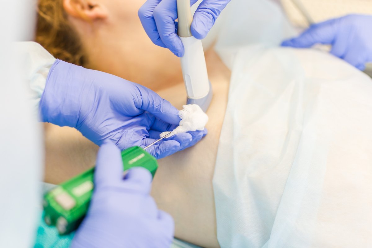 Безоперационное удаление новообразований молочной железы