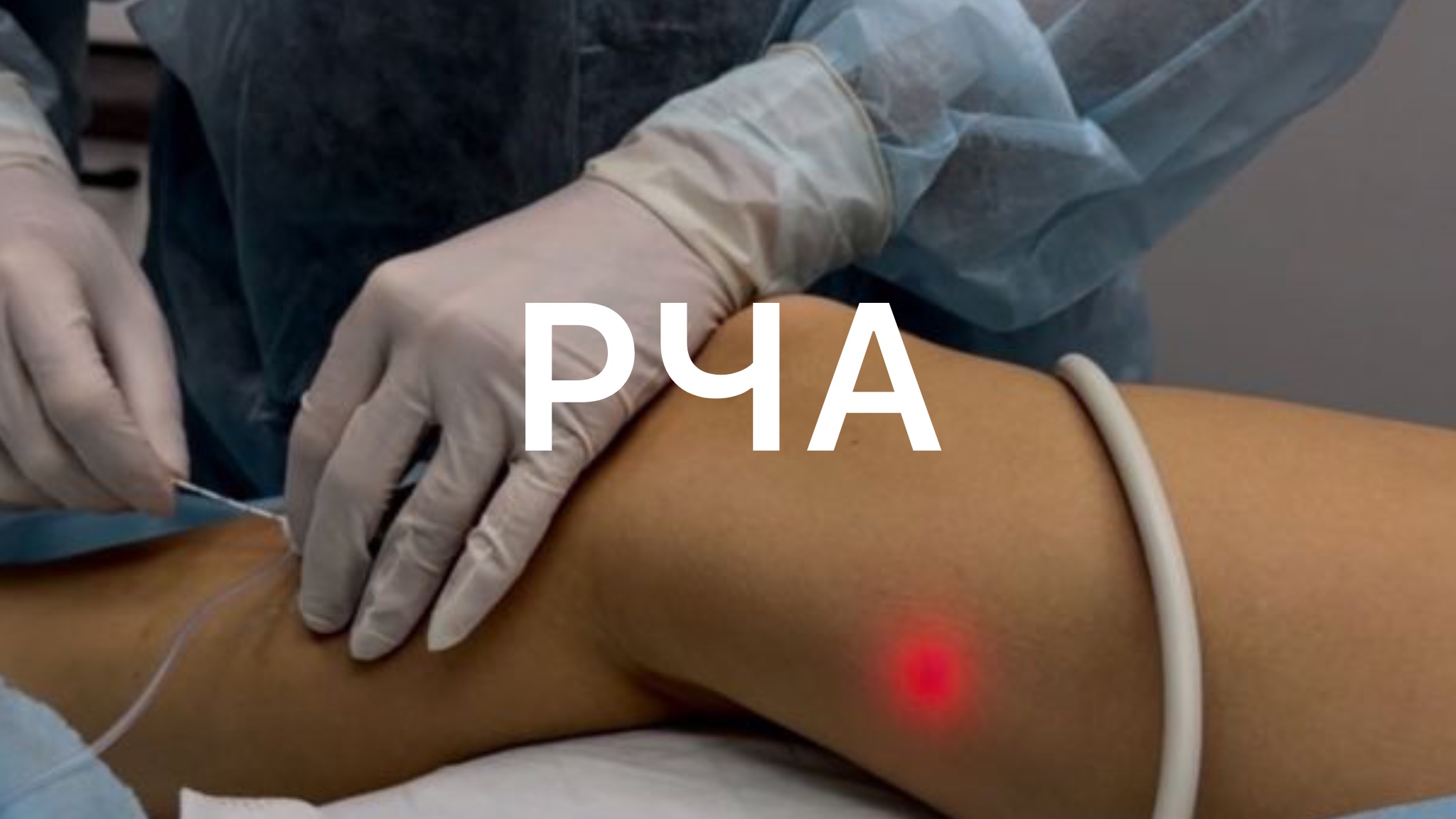 Как мы проводим РЧА?