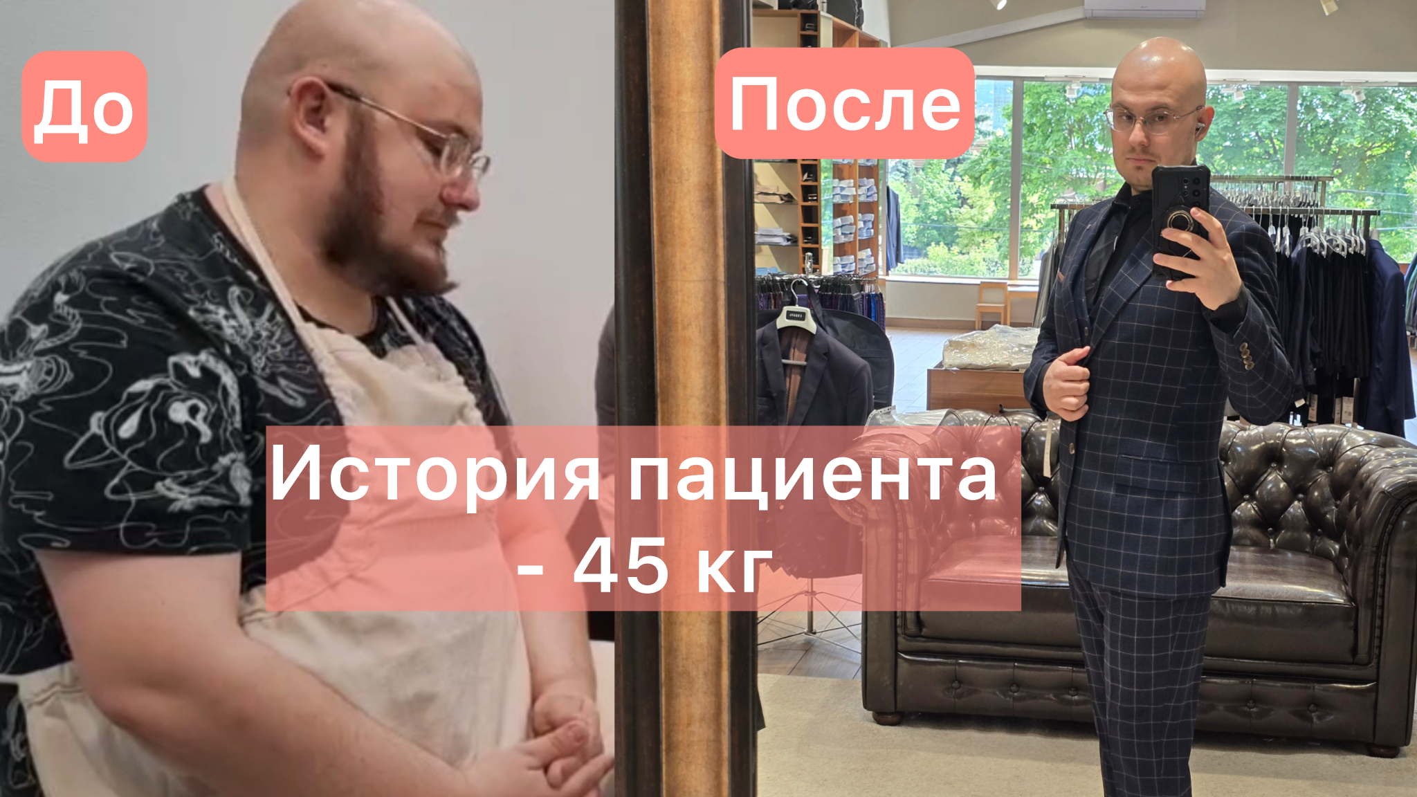 История пациента: похудел на 45 кг