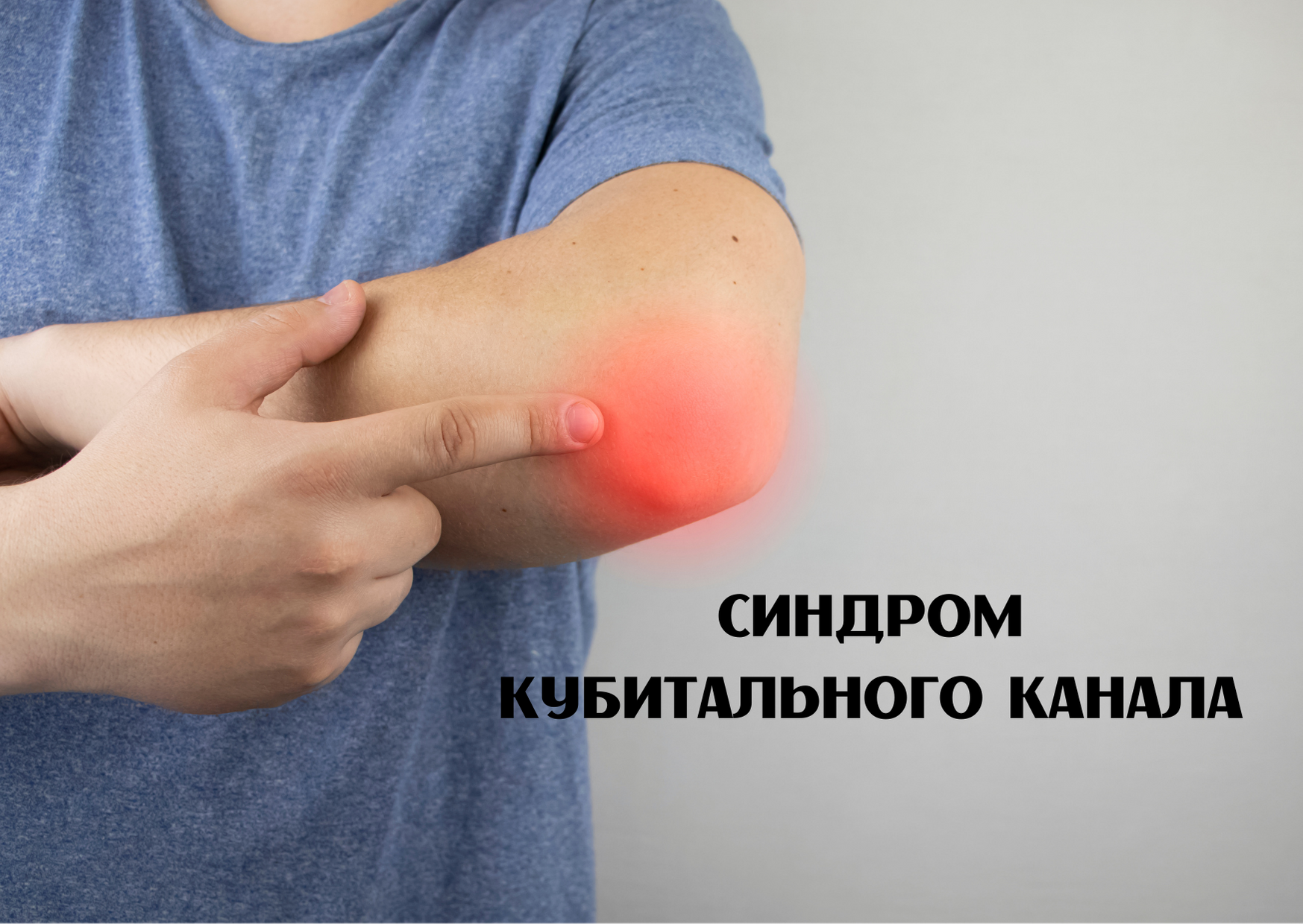 Синдром кубитального канала
