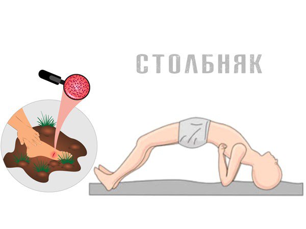 Киста почки