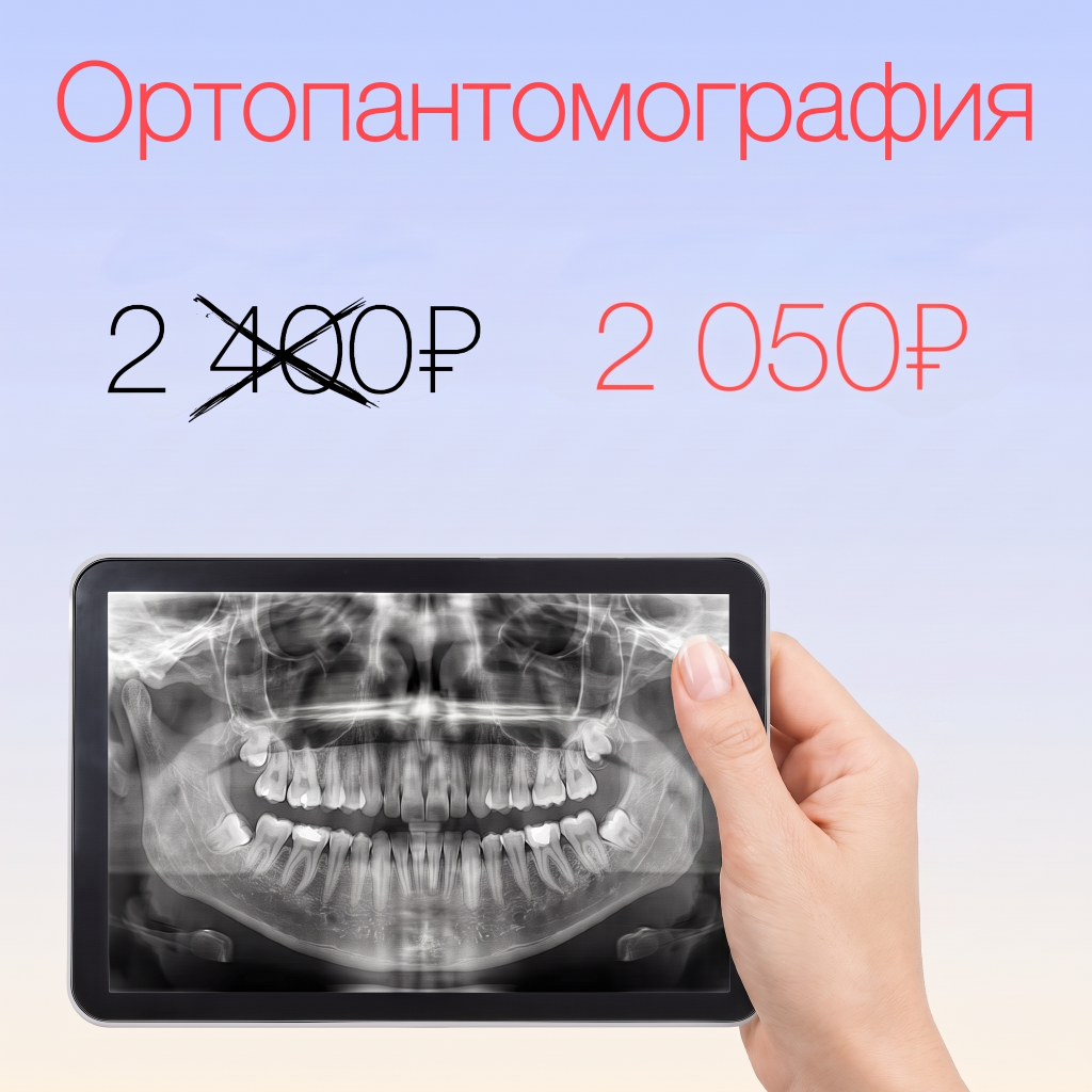 Акция