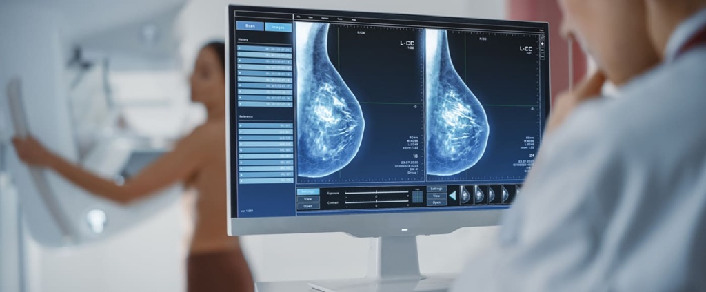 Маммография