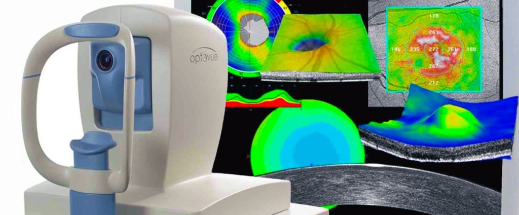 Оптическая когерентная томография