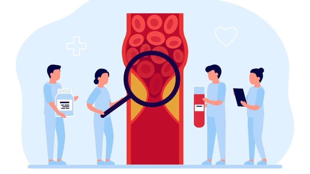 Атеросклероз: причины, опасности и лечение в Доктор Боголюбов 